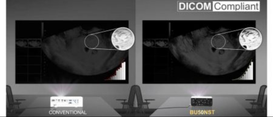 Screenshot 2025 09 21 at 17 29 04 Ansi Lumen Beamer LG ProBeam BU50NST Laserleuchtmittel 4k UHD