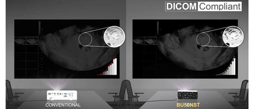 LG BU50NST erfüllt auch den DICOM Standard - beamer-freund, ansi lumen beamer